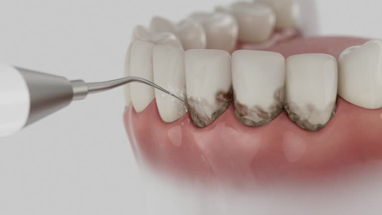 Reliable Dental Implants contractor in Evadale, TX by Smile Center Dentistry